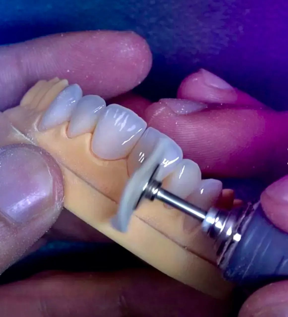 Prótese dentária em geral  - Foto 2