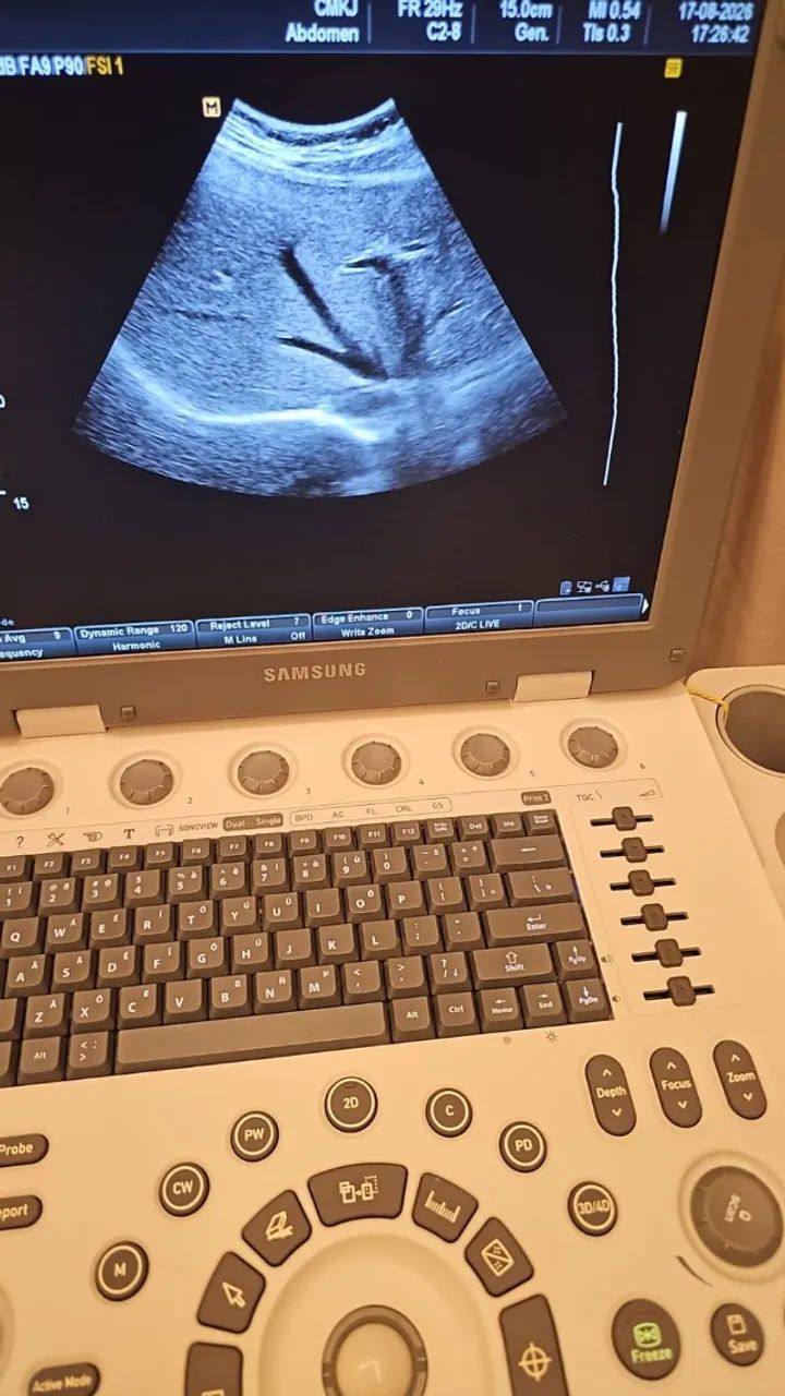 ULTRASSOM SANSUNG U6 - Foto 3