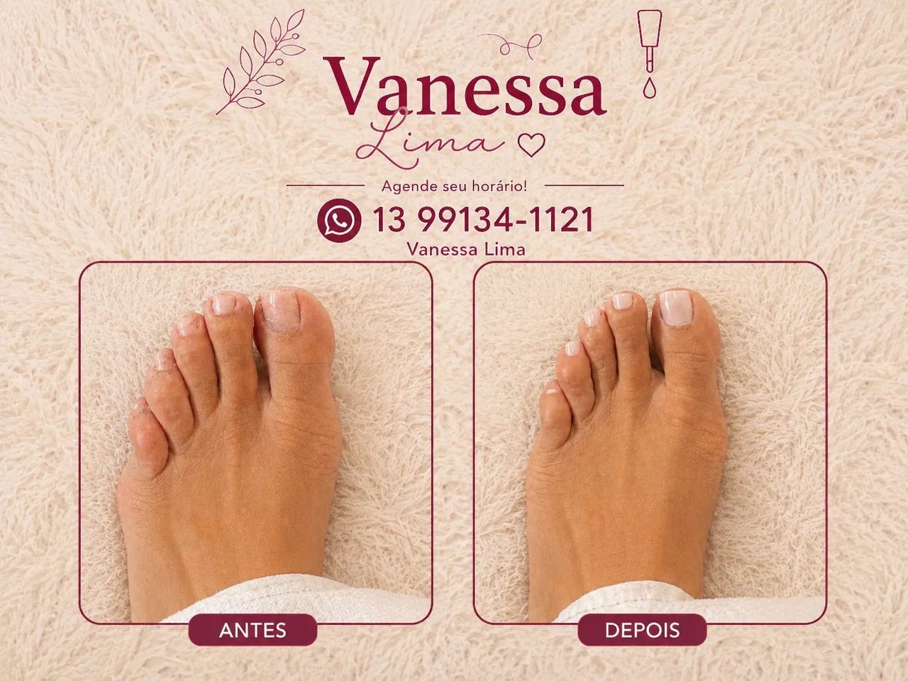 Manicure a domicílio  - Foto 4
