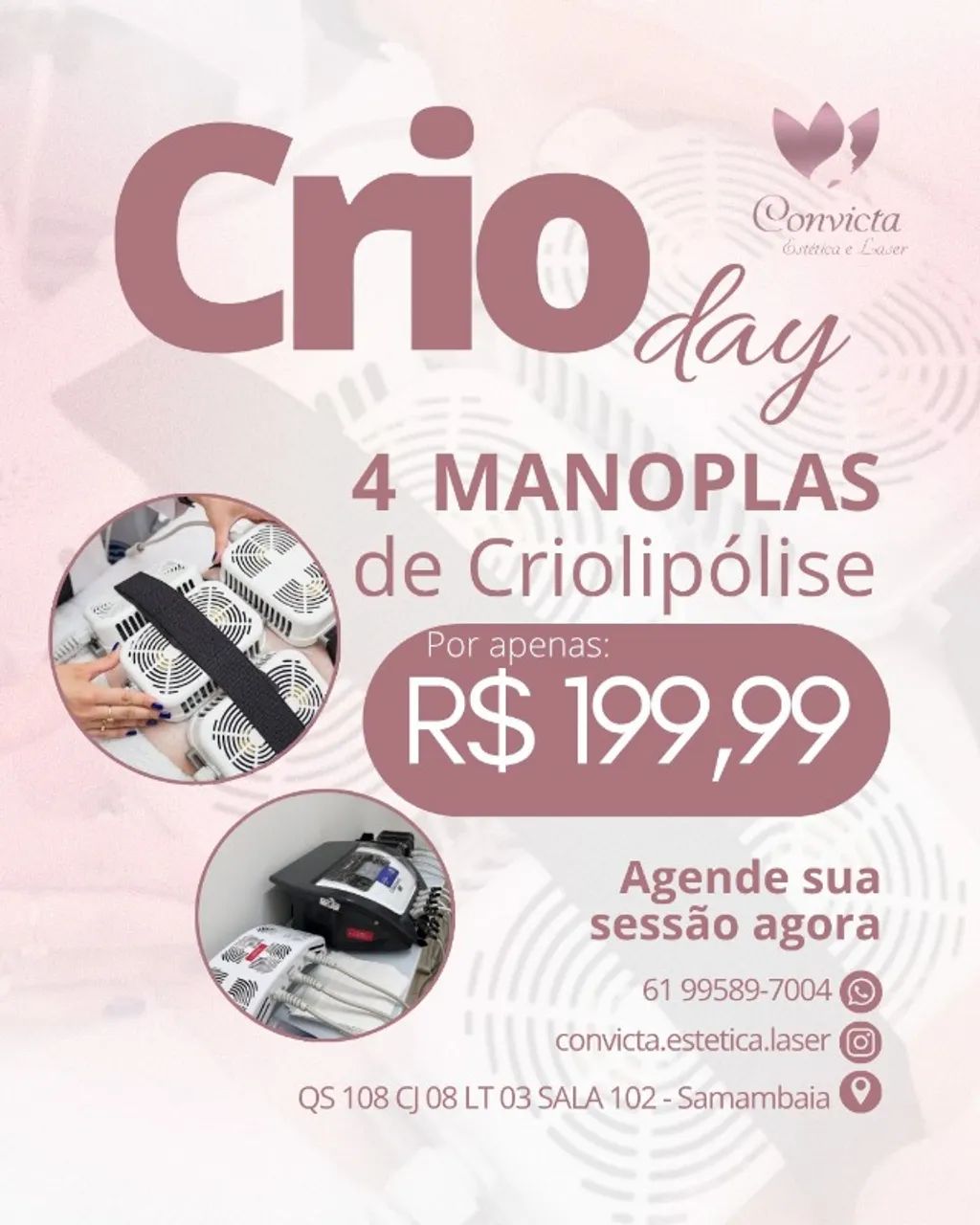 Criolipólise day 22/07/25