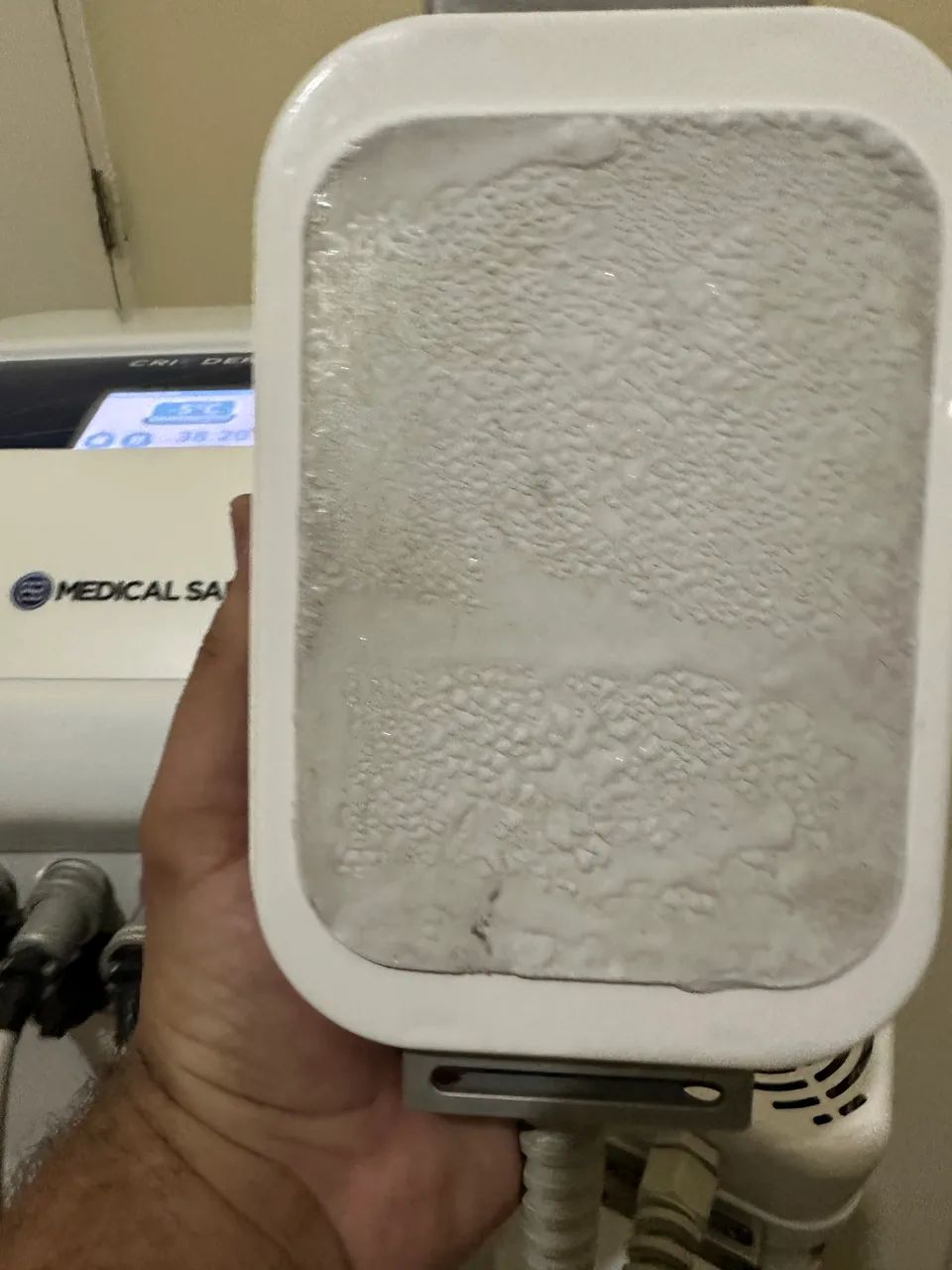 Criodermis Criolipolise de placas  - Foto 3