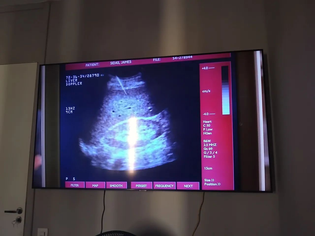 Tv 65 polegadas Samsung 