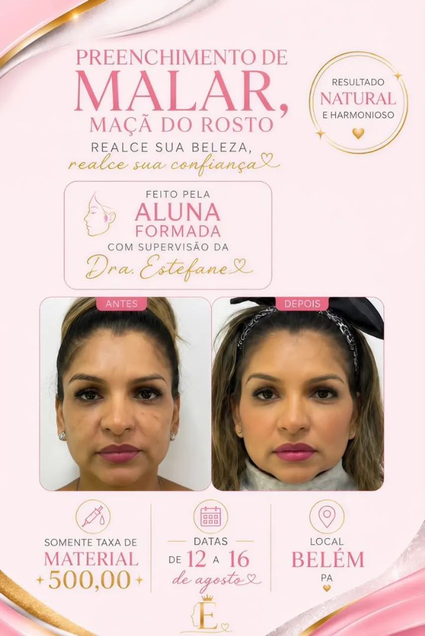 VAGA PARA PACIENTE MODELO FULL FACE - Foto 5