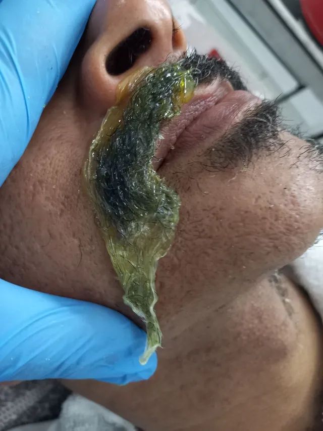 Depilação e Epilaçâo + Spa Terapia , terapia das pedras 