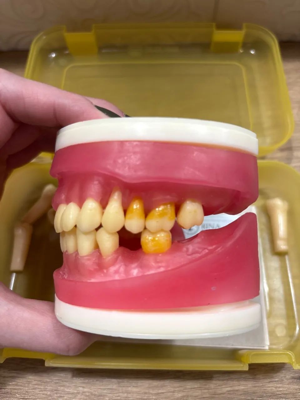 Manequim PRONEW periodontia (refil)  - Foto 4