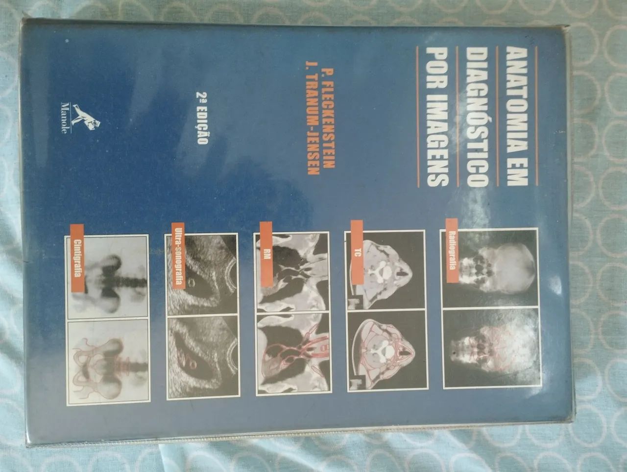 Anatomia em Diagnóstico por Imagens -2° edicao 2ª Edição