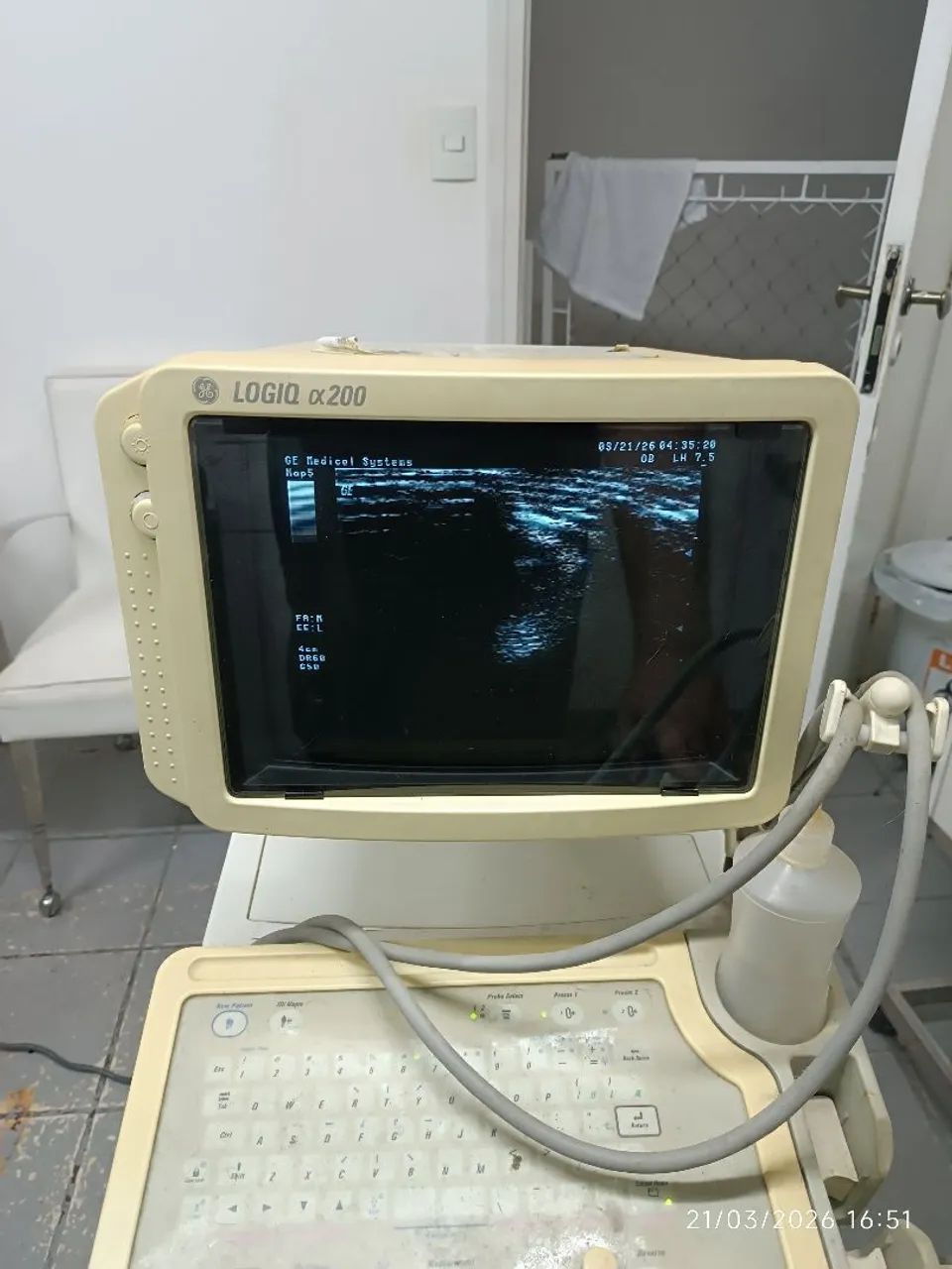 Ultrassom GE Lógic 200 - Foto 2