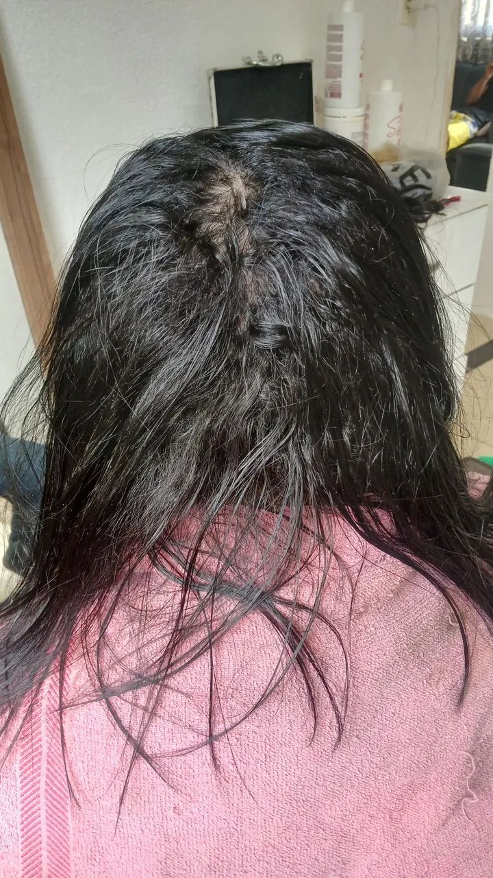 Selagem Led terapia a domicílio 