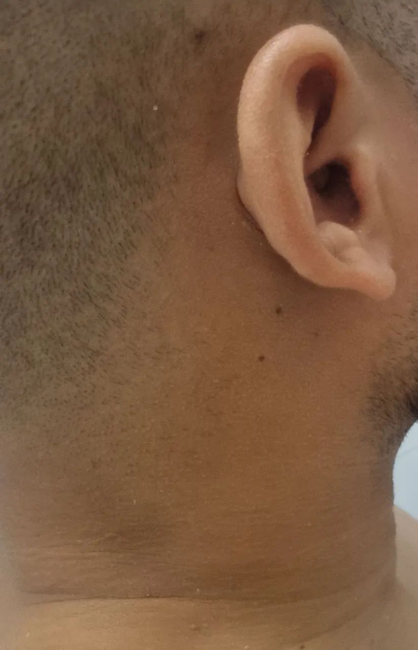 Microponto de Ouvido Espião - HERO-800 - Foto 5