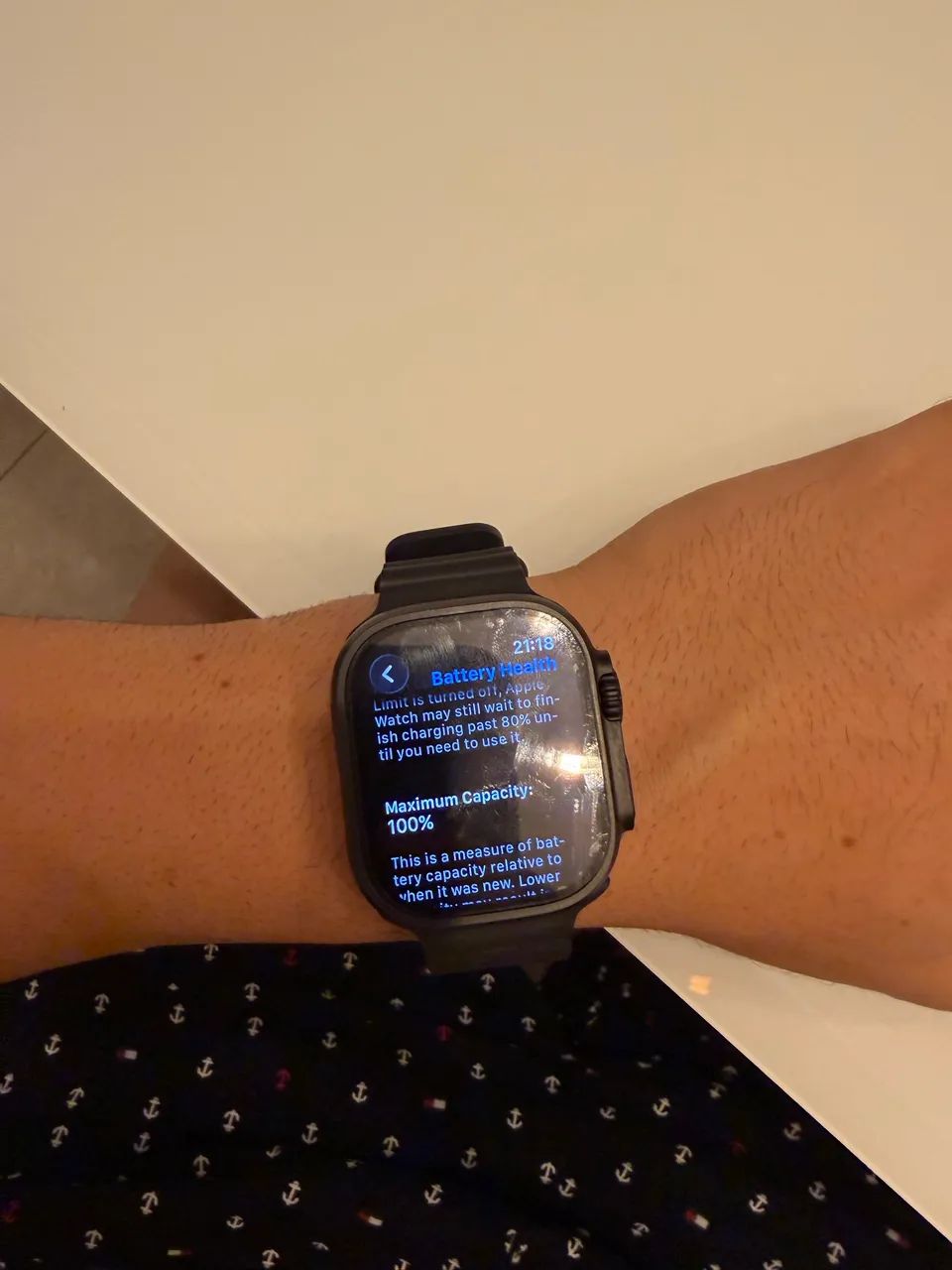 APPLE WATCH ULTRA 3  - Foto 2