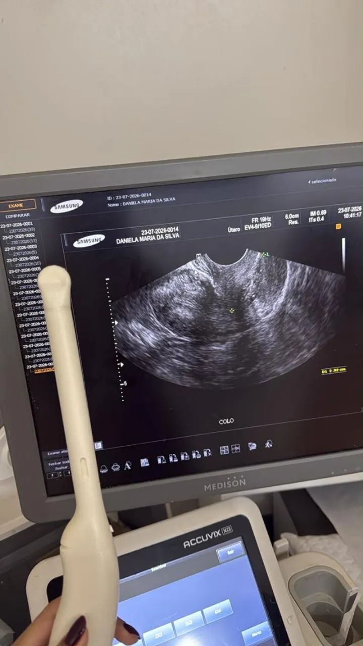 Máquina de USG com os 3 transdutores SAMSUNG - Foto 5