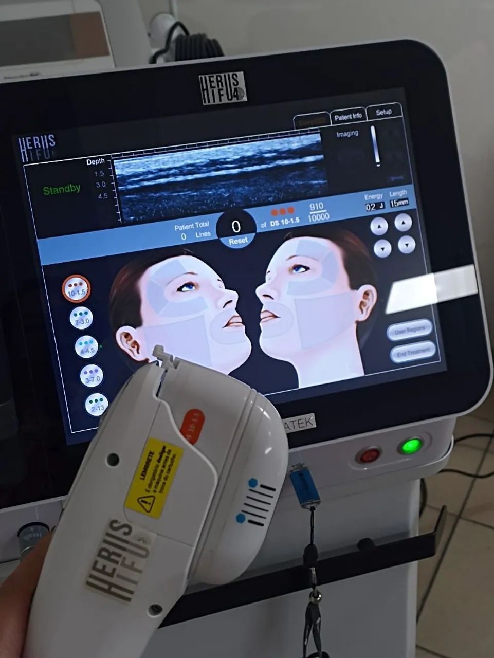 Ultrassom Microfocado Herus 4D - Foto 2