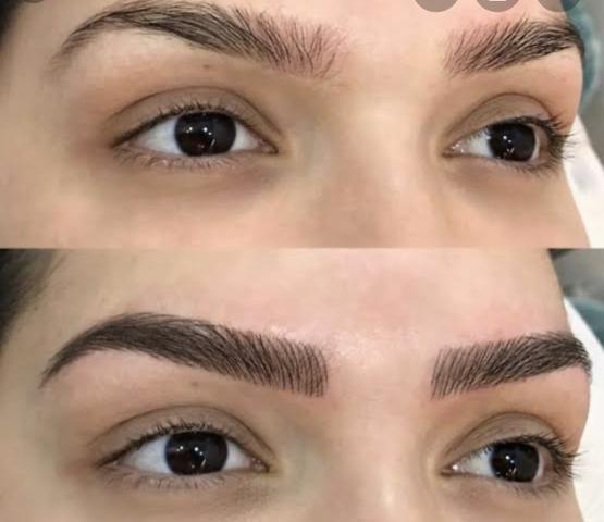 Estética e Depilaçao - Foto 2