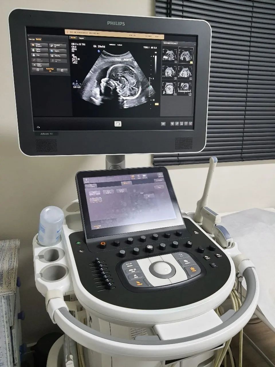 Aparelho de ultrassom 