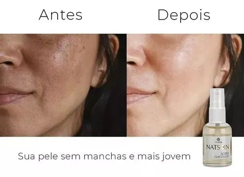 ácido glicólico revendo manchas - Foto 4