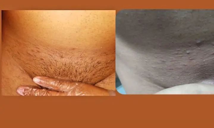 Depilação  - Foto 2