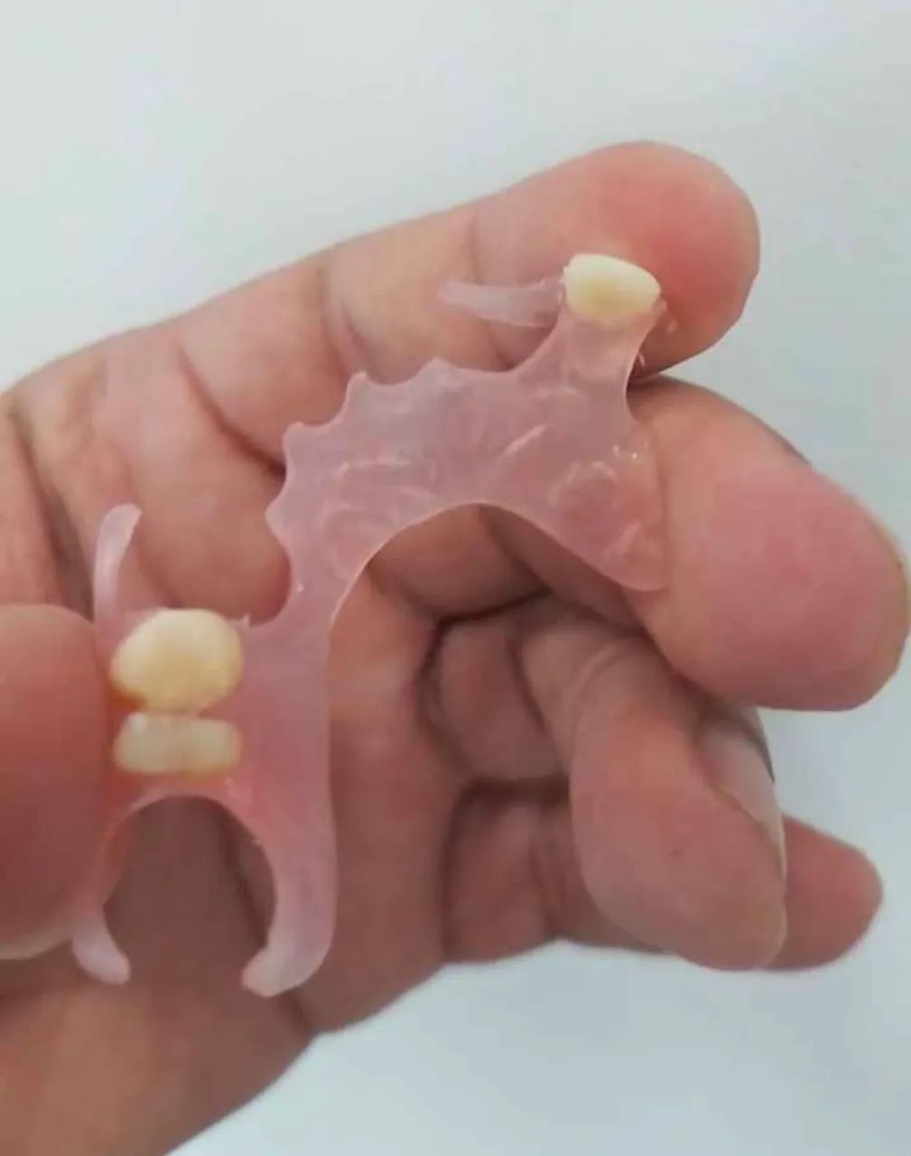 Prótese dentária flexível - Foto 2