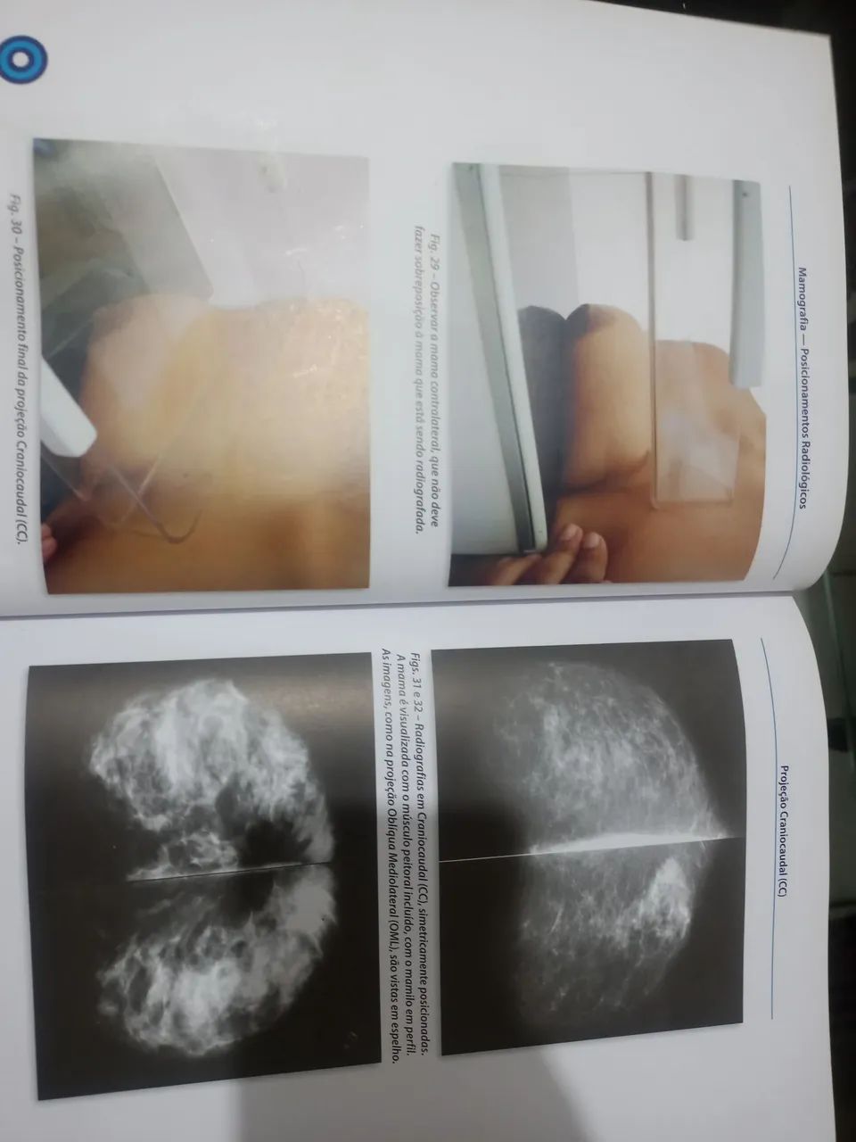 COMBO TRATADO DE RADIOLOGIA, MAMOGRAFIA E RADIOLOGIA TECNICAS PRATICAS - Foto 5