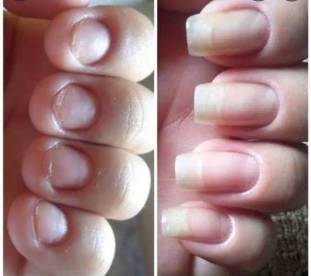 BASE FORTALECEDORA CRESCER UNHAS E MATA FUNGOS 