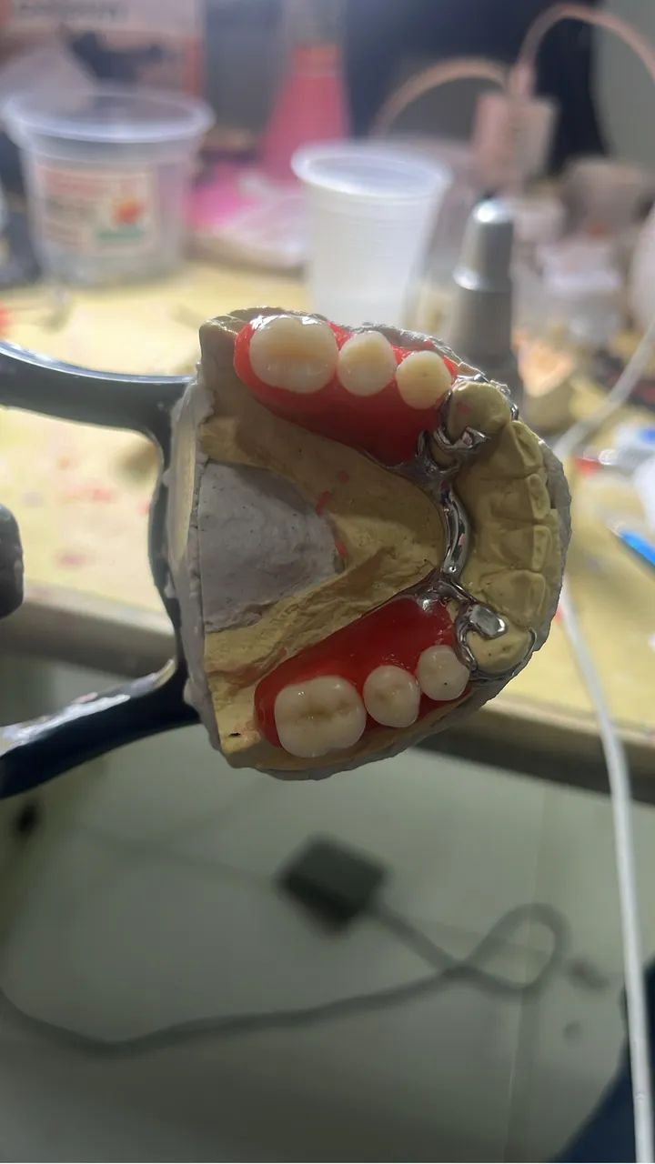 Prótese dentária em geral  - Foto 5
