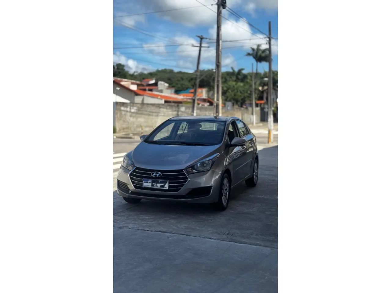 Hyundai Hb20S 2018