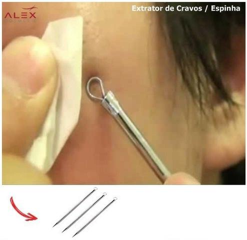 Extrator de Cravos e Espinhas Barato - Cuiabá