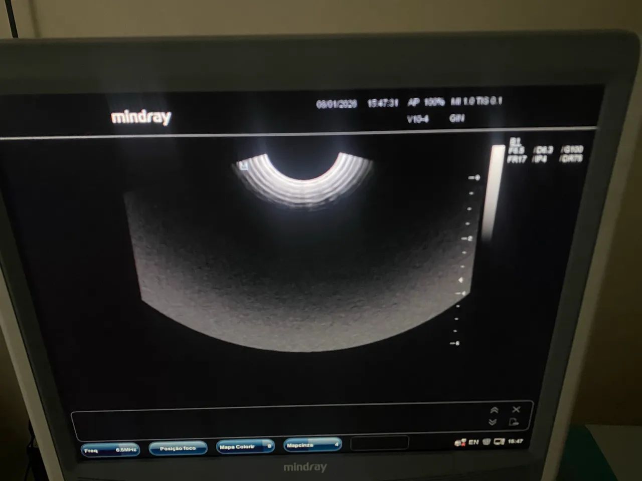 Ultrassom Mindray DC7 - Foto 4