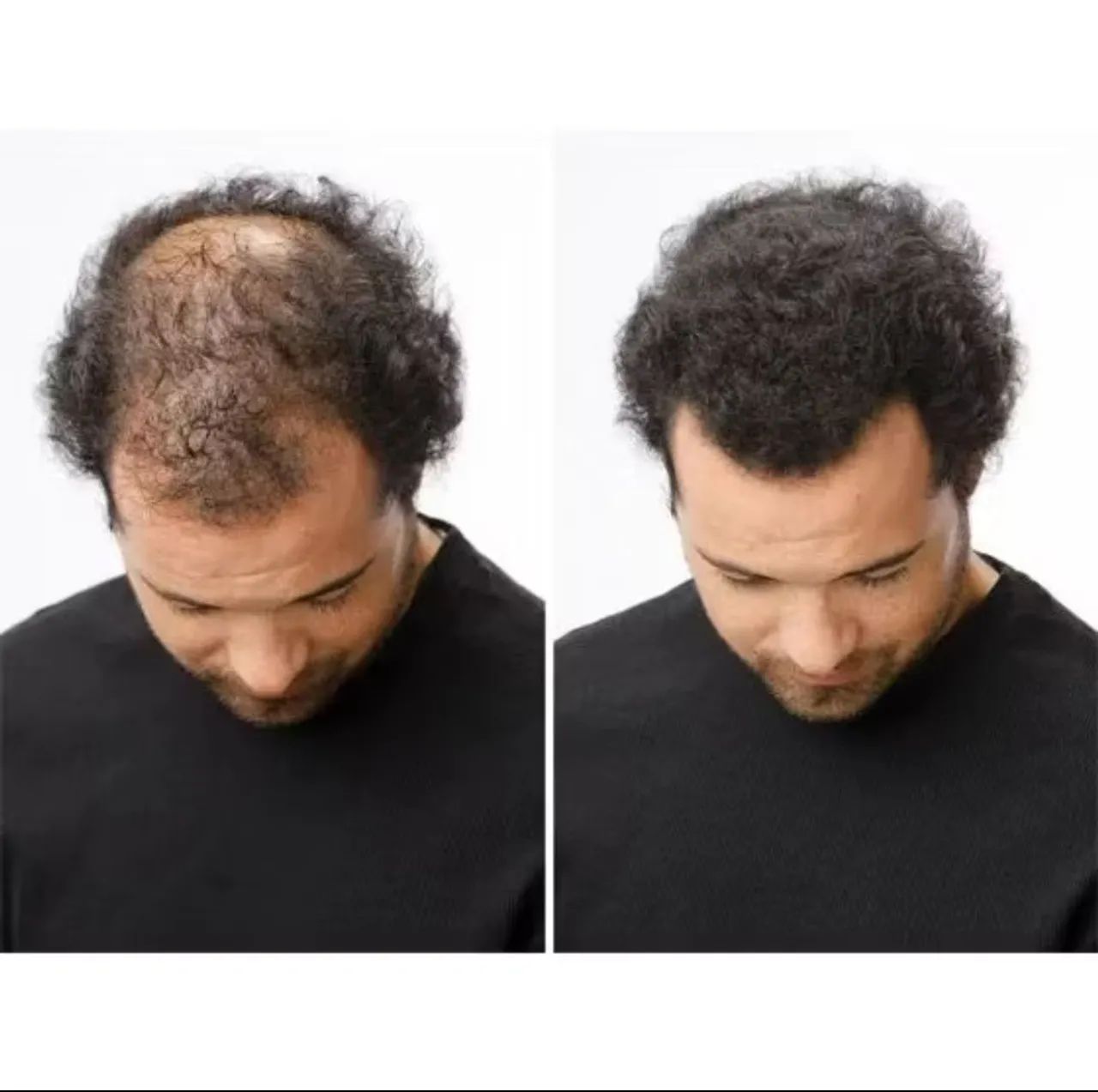 Fibra Capilar Preto, maquiagem para cabelo  - Foto 2