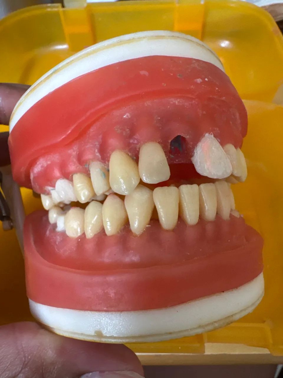 Manequim pronew dentística - Foto 3