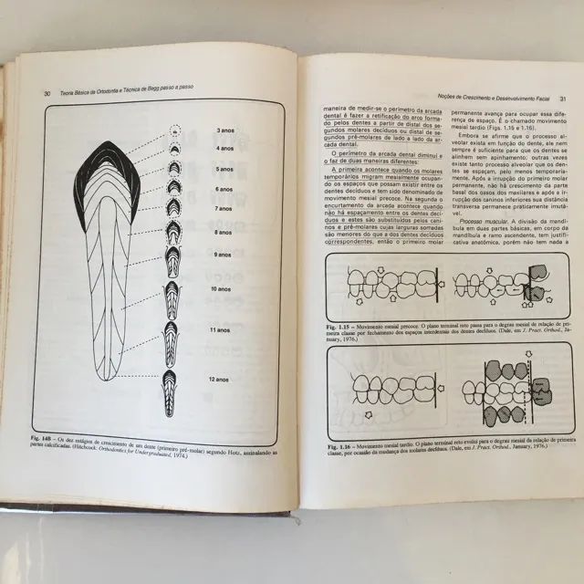 C045 - Livro Ortodontia Clínica Passo A Passo Cyro de Moura - Foto 5