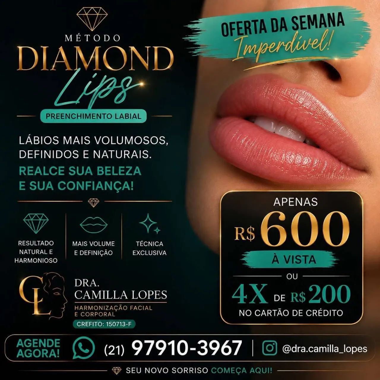 Preenchimento labial em Icarai 
