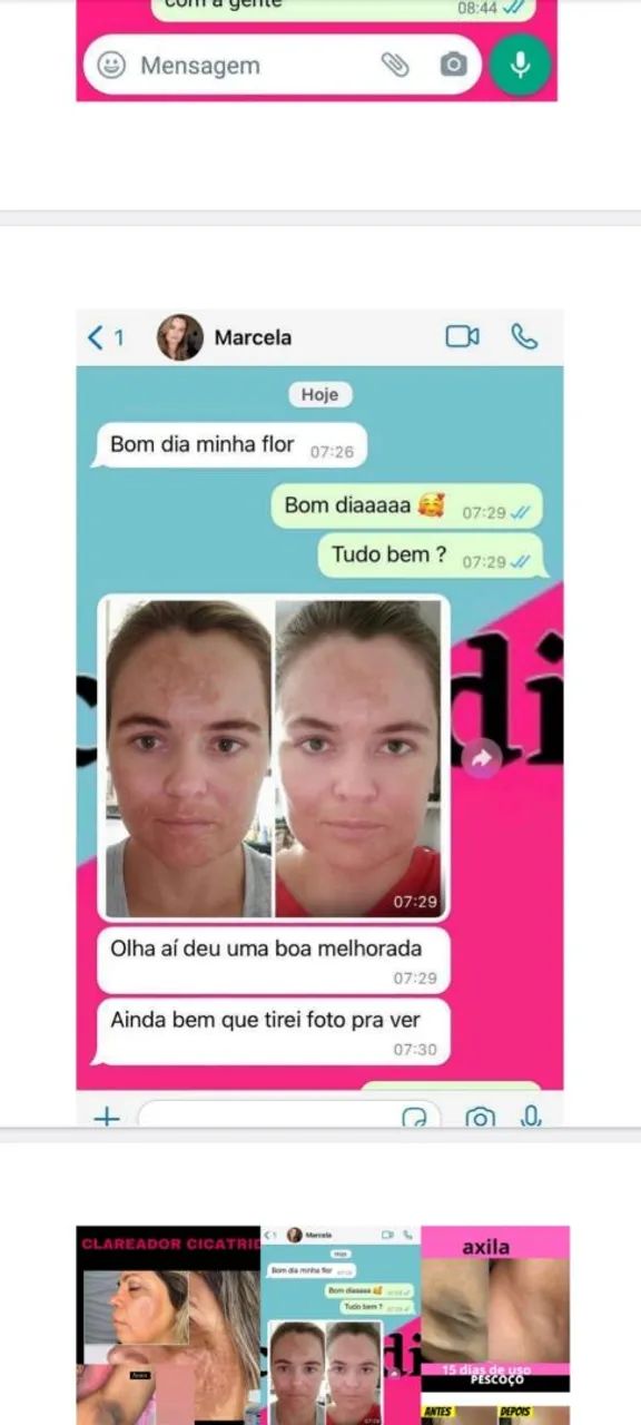 Clariador de pele  - Foto 4