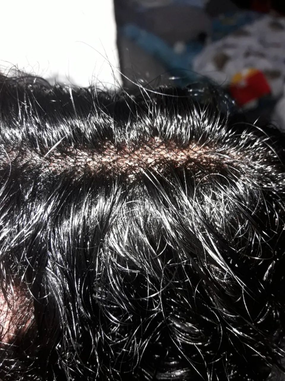 Vendo Lace Wig de Cabelo Humano  - Foto 2