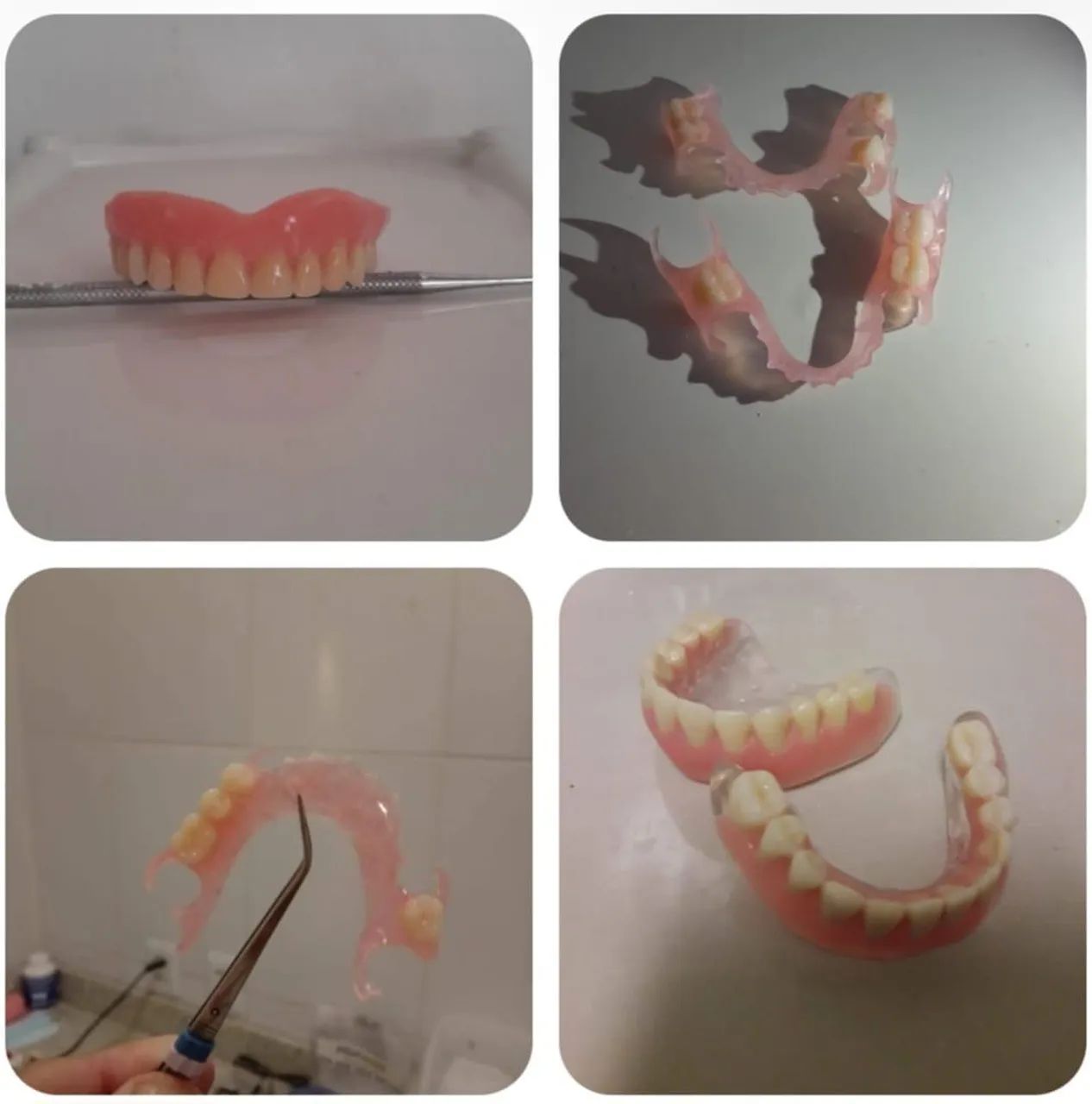 Prótese dentária  - Foto 2