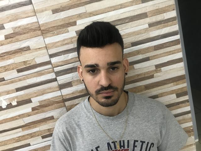 Prótese capilar