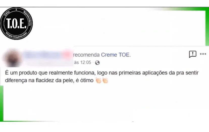Creme Toe - Tratamento Ortomolecular para Estrias  - Foto 5