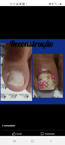 Reconstrução das unhas dos pés  - Foto 3