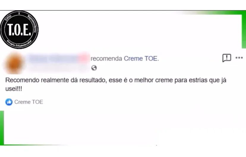 Creme Toe - Tratamento Ortomolecular para Estrias  - Foto 4