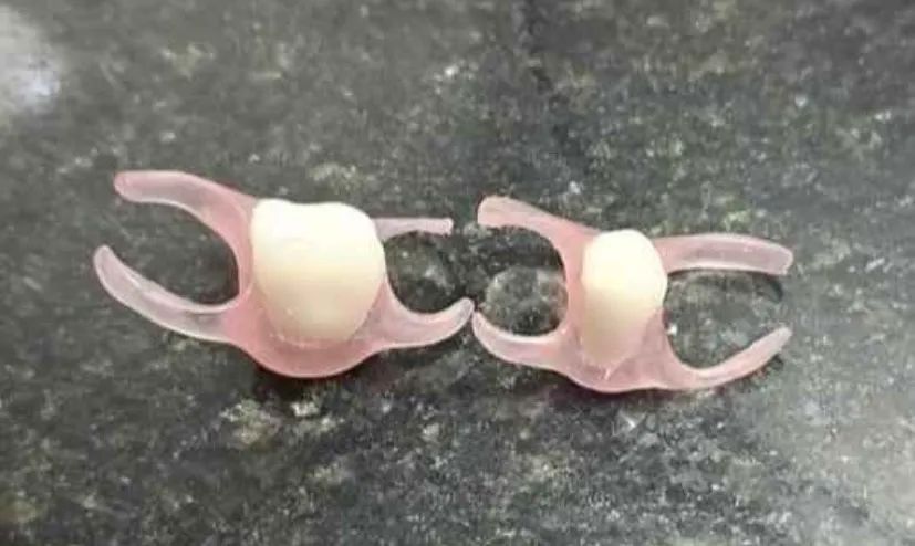 Prótese dentária flexível - Foto 5