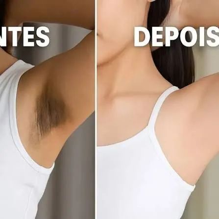 Clariador de pele  - Foto 3