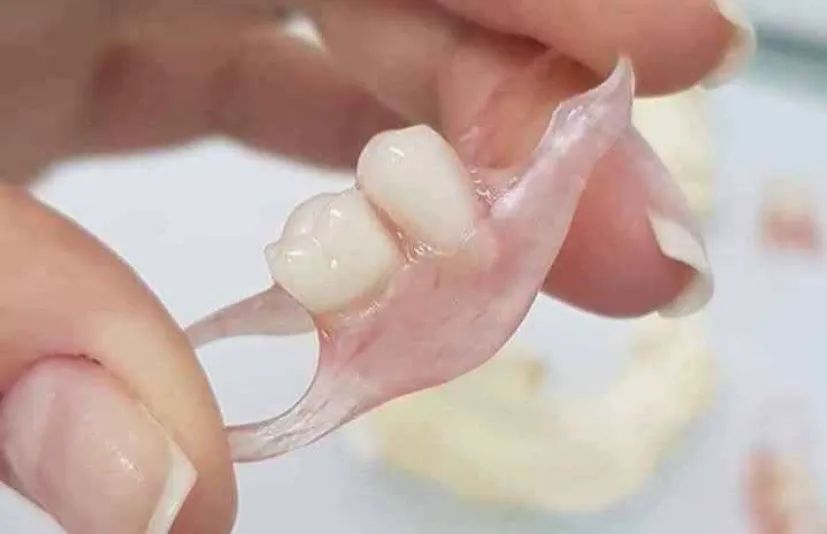 Prótese dentária flexível - Foto 4