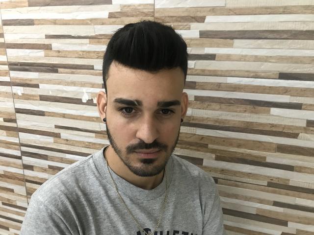 Prótese capilar - Foto 5