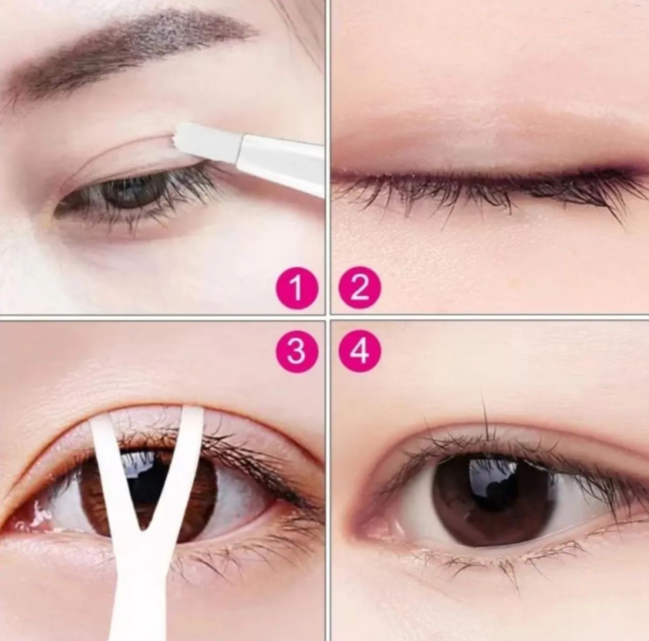 Cola pra Redução de Pálpebras  - Foto 4