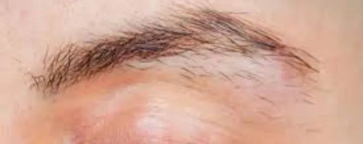 A domicílio e residência  - Foto 3