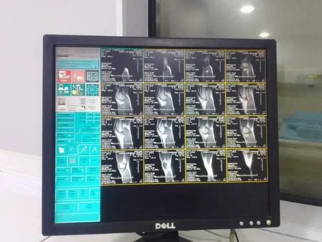 RESSONANCIA MAGNETICA GE ABERTA - Foto 4