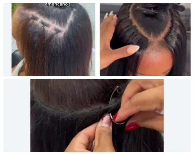 Cabelo bio humano em telas de topo de cabeça. - Foto 2
