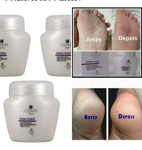 Desodorante Antireesecamento para seus pés  - Foto 3