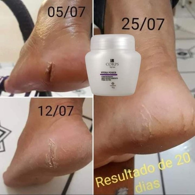 Desodorante Antireesecamento para seus pés 