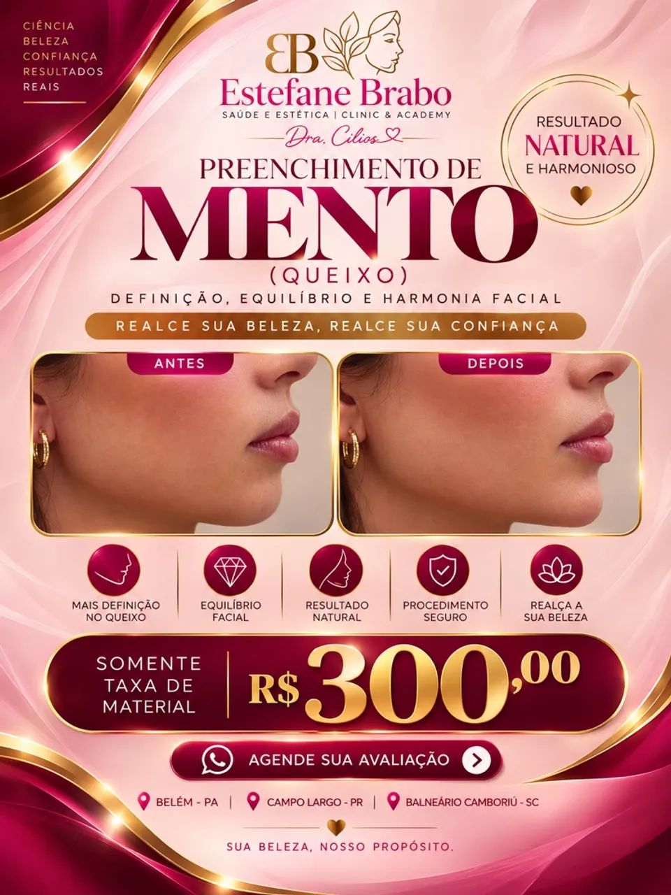 Vagas para paciente modelo em Belém! - Foto 3