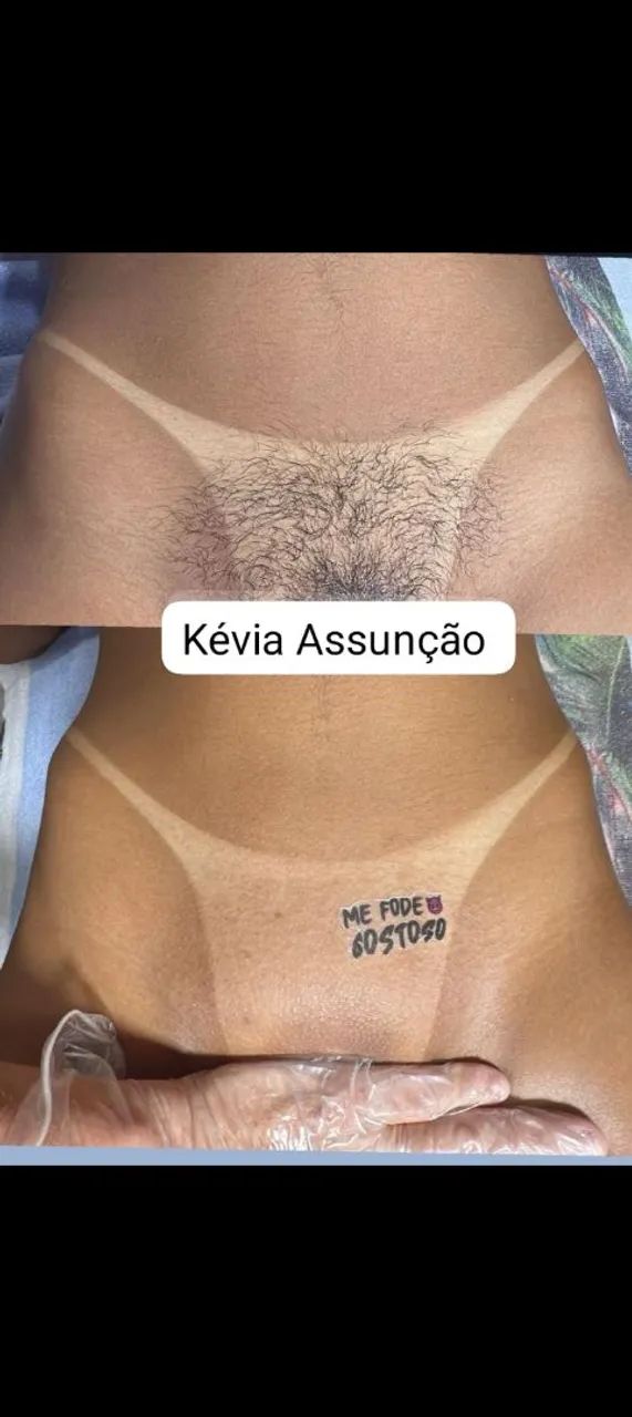 Epilação de virilha a domicílio 
